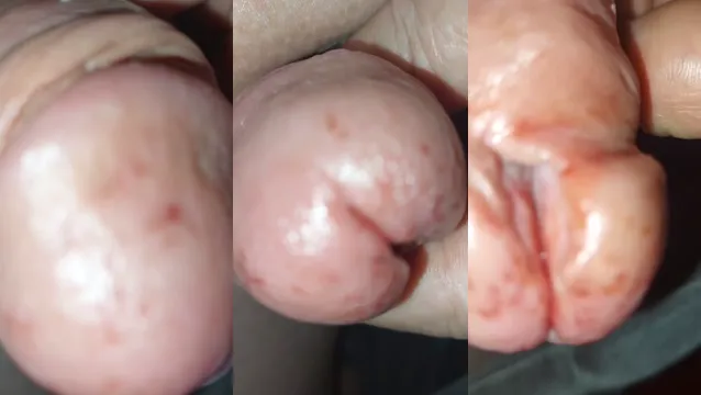 Watch Extreme CBT Insertion BDSM Fetish - Painful Perversion Unleashed full viral video leaked