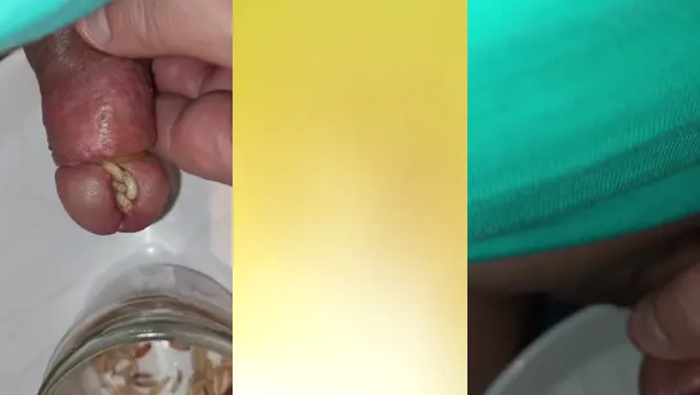 Extreme CBT BDSM Insertion - Perverse Maggot Feeding Pain Fetish